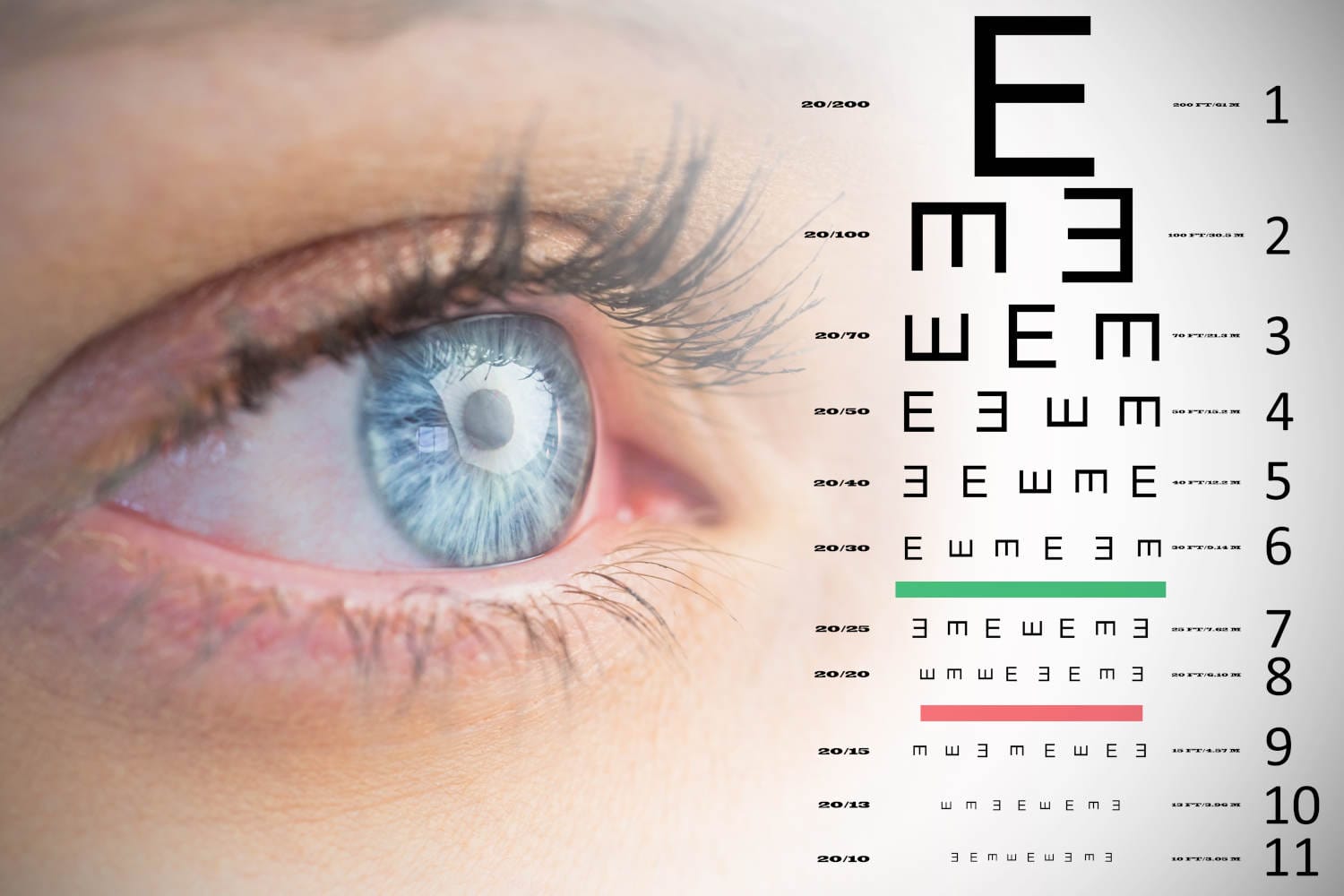 Augenlasern: Wie lange hält das?