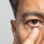 Auge zuckt